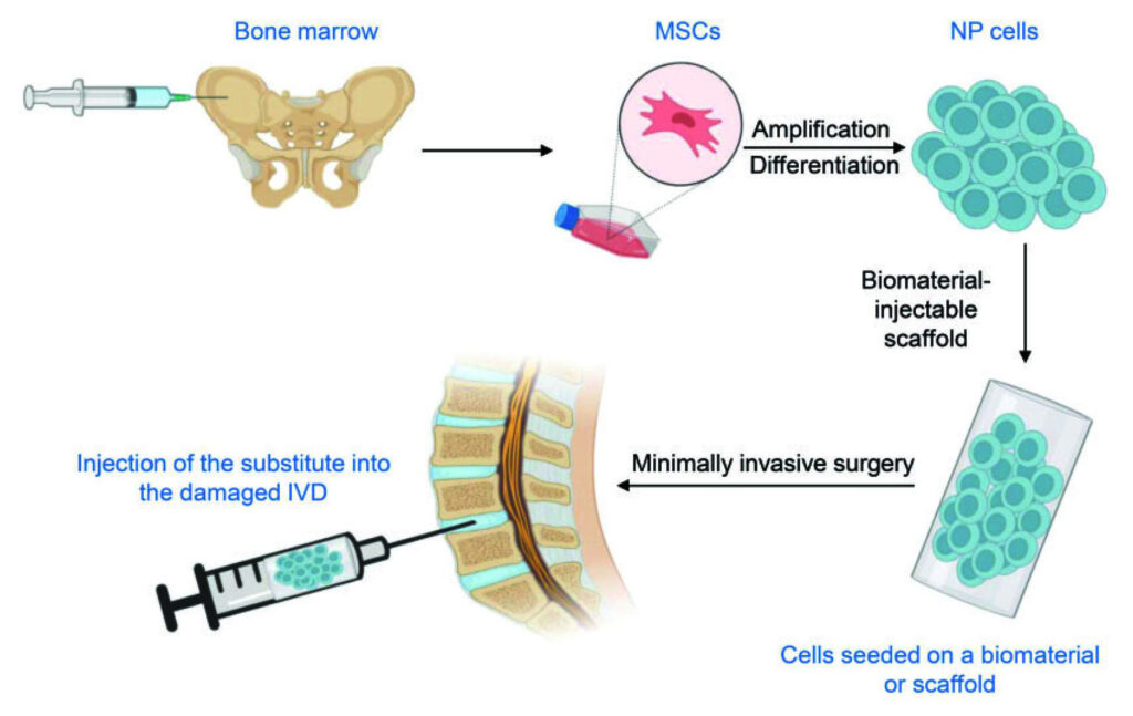 How Stem Cell Therapy Works 3