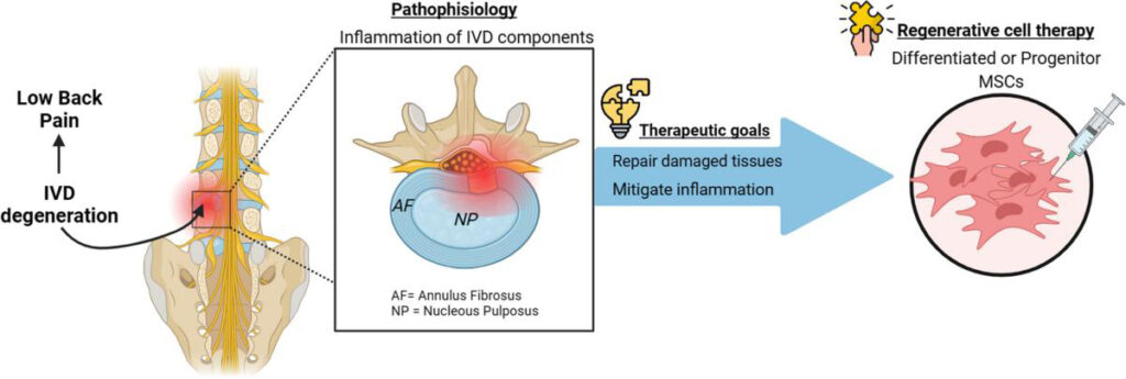 Pathophisology