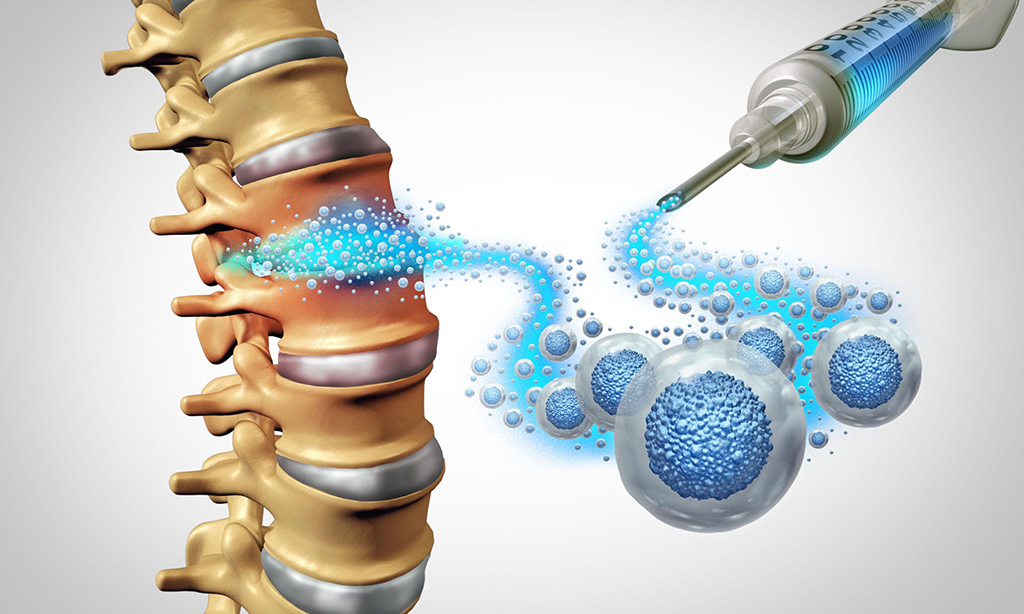How Stem Cell Therapy Works